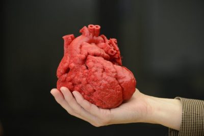 Какво е непълен сърдечен блок