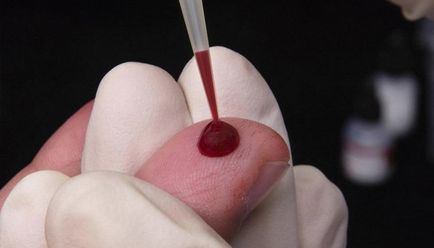 Общ анализ на кръв от пръста