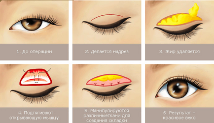 Как да промените формата на окото