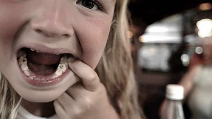 Как да се лекува зъб дете