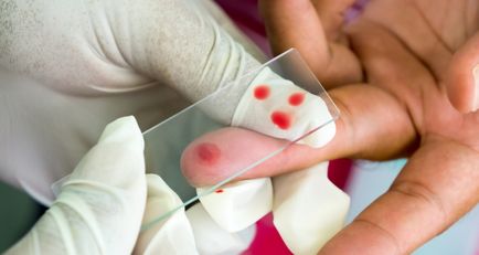 Общ анализ на кръв от пръста