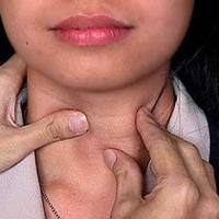 обем на щитовидната жлеза при децата