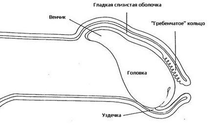 лечение юздичка