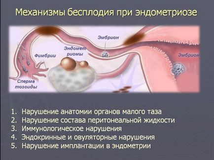 Точността на ултразвук