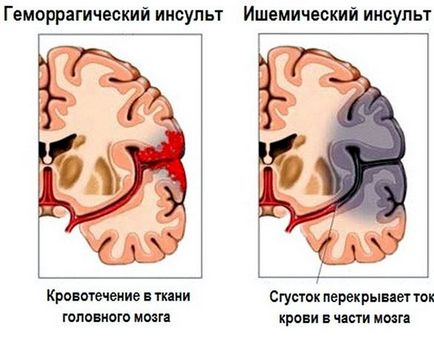 Алън Кар как да отслабна аудиокнига Алън Кар как да отслабна аудиокнига