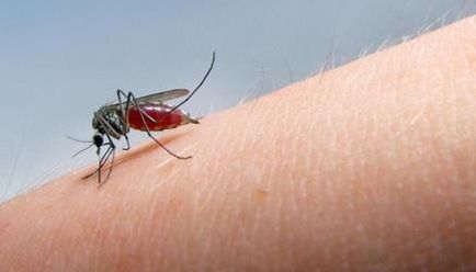 Това облекчава сърбеж от ухапвания от комари