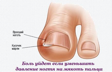 Какво да правим с ноктите на краката