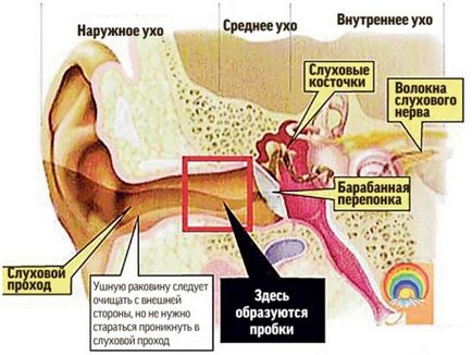 Уши как да извадите щепсела от ухото