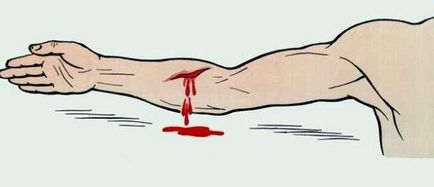 Как да запазим кръв