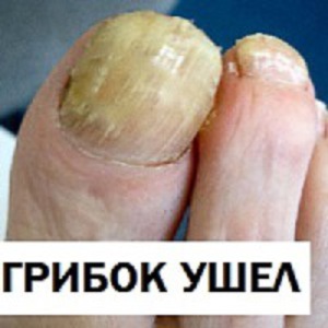 Какво да правим с ноктите на краката