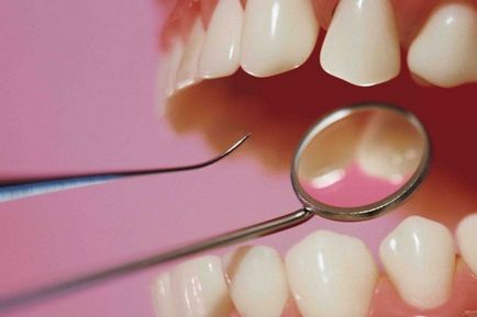 Какво се разпада зъби по време на сън