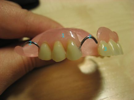Какво е най-подвижни зъбни протези ламинарни