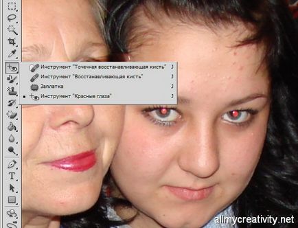 Как да премахнете червени очи от снимки