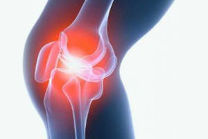 кисти на колянната става Бейкър - за домашно лечение народни средства