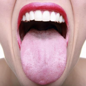Tongue покритие бял цвят причини и как да го (език) се премахне Tongue покритие бял цвят причини и как да го премахнете