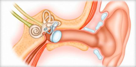 Усещане за вода в ухото какво да правя, как да се води, специални капки за rasstvoreniya ушна кал
