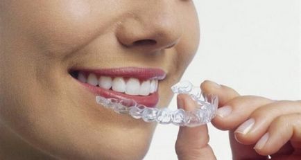 Избелване на зъби в домашни условия - най-добрите начини и ревюта