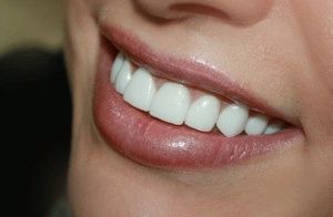 Арт възстановяване на предните зъби, я преглед на методите и цени