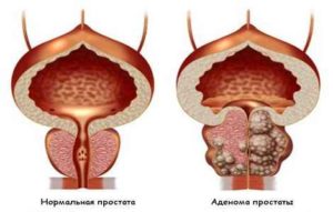 за третиране на ДПХ народни средства