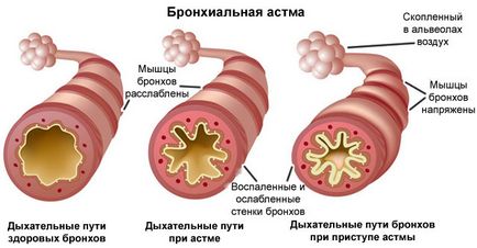 Блокери Какво има, видовете, списъкът на лекарства, които действат като