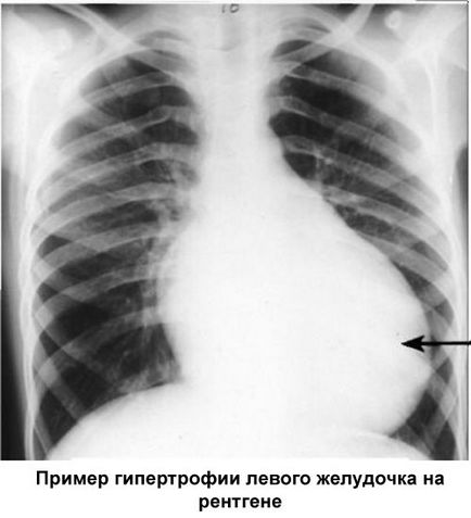 Блокери Какво има, видовете, списъкът на лекарства, които действат като