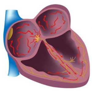 Болест на сърцето е даден списък на болести, симптоми и лечението