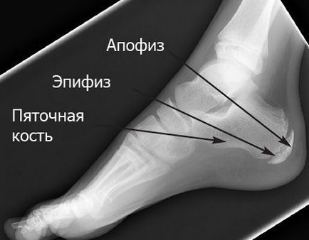 shintsa-halungda заболяване при деца като лечение, лечение на народната медицина, снимки