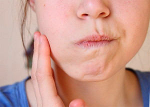 Боли езика при преглъщане, от една страна, и как да се отнасяме причините за болестта