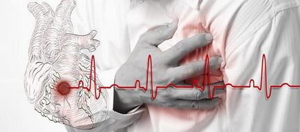Сърдечна болка - симптом на какво да се прави, ако го боли сърцето