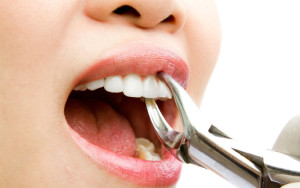Колко може да се консумира след премахване на зъба и не можете да ядете това, което храни