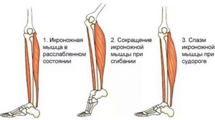 Какво става, ако мускулите на краката шофиране, причина и лечение