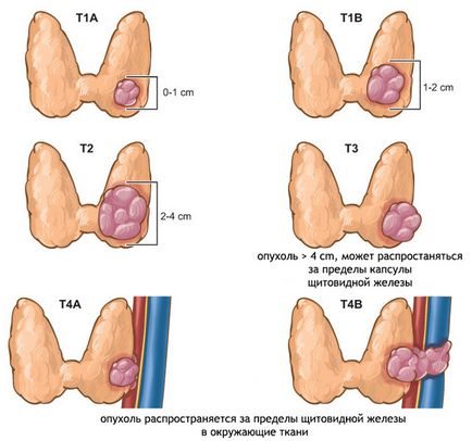 Какво ще щитовидната жлеза ултразвук