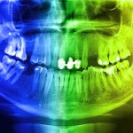 Какво е най-високата точка в стоматологията