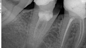 Какво е radioviziografiya, когато се използва в стоматологията и е същността на изследването
