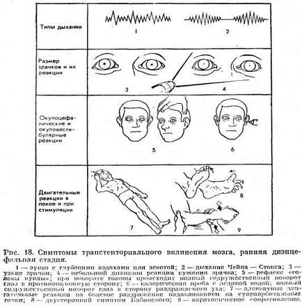 Диференциална диагноза на коматозни състояния