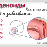 Ефективното лечение на обикновена настинка при малки деца народни средства