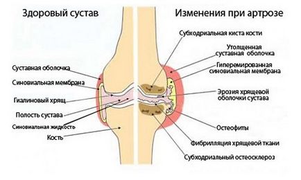 Ластични на коляното си и правото да налагат (вятър), упътване за употреба