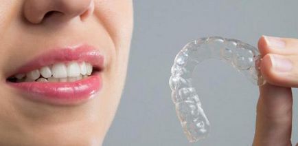 Aligners прегледи на капа за привеждане в съответствие на зъби