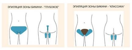 Епилацията с пинсети бикини у дома