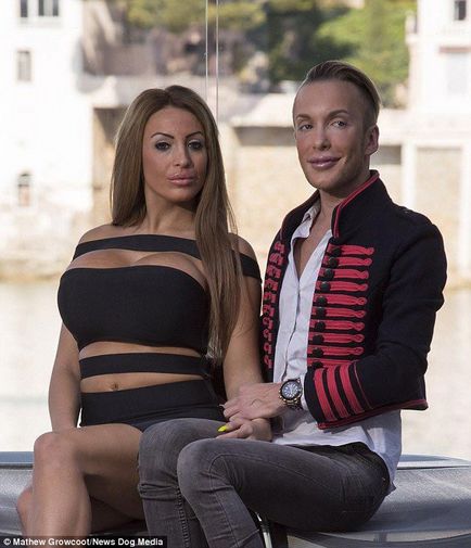 Френска двойка е прекарал повече от $ 300 хиляди, за да бъде като Барби и Кен, umkra