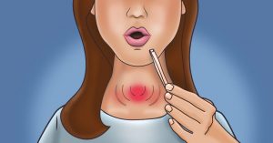 Къде е щитовидната жлеза и какво е неговото предназначение