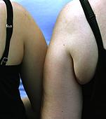Хормони и наднормено тегло, хормоните влияние върху жени с наднормено тегло