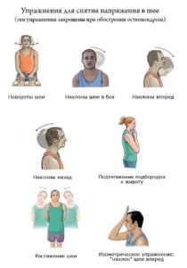 Как правилно да се укрепи мускулите на шията с остеохондроза