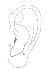 Как да се установи болестта на меката част на ухото