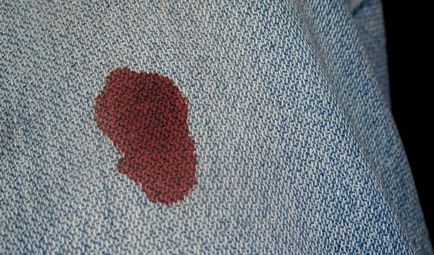 Как да се измие кръвта от дрехите си у дома