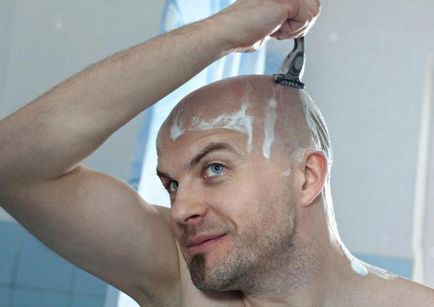 Как да се обръсне nalyso за плешив грижи на главата колко повторен растеж на косата