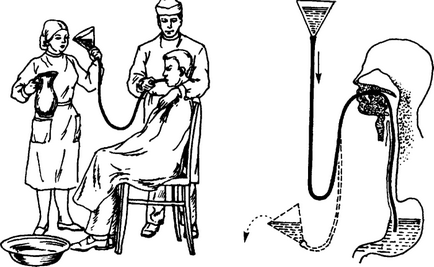 Как да се промият стомаха у дома за възрастни и деца