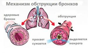 Как да се лекува кашлица при възрастни ефективни начини