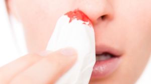 Как да причини кървене от носа бързо, безопасно и без болка