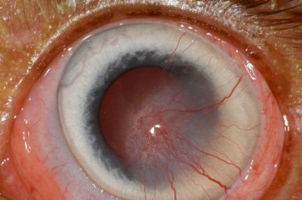 Кератит очни симптоми и лечението